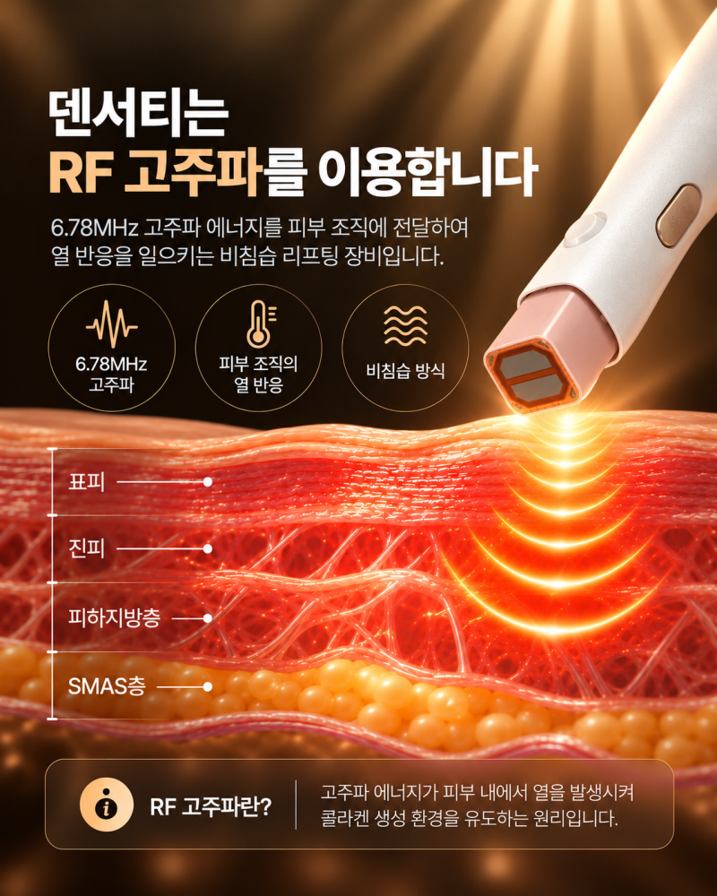 서면덴서티알파팁,어떤 원리일까요?고주파 방식부터 팁의 특징 사진 3