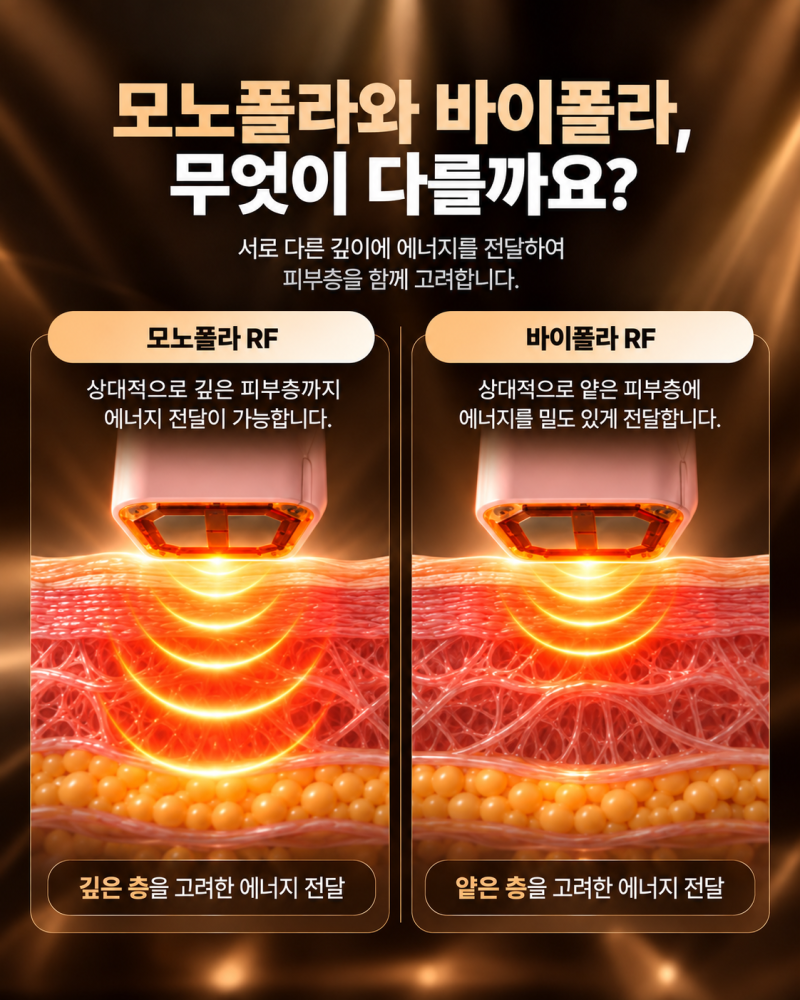 서면덴서티알파팁,어떤 원리일까요?고주파 방식부터 팁의 특징 사진 4